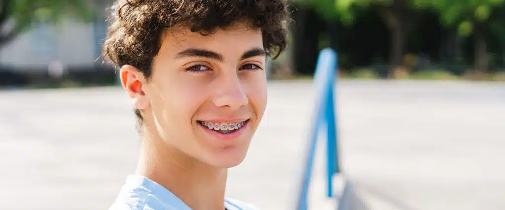 traditional braces
